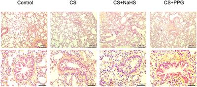 Hydrogen Sulfide Inhibits Cigarette Smoke-Induced Endoplasmic Reticulum Stress and Apoptosis in Bronchial Epithelial Cells